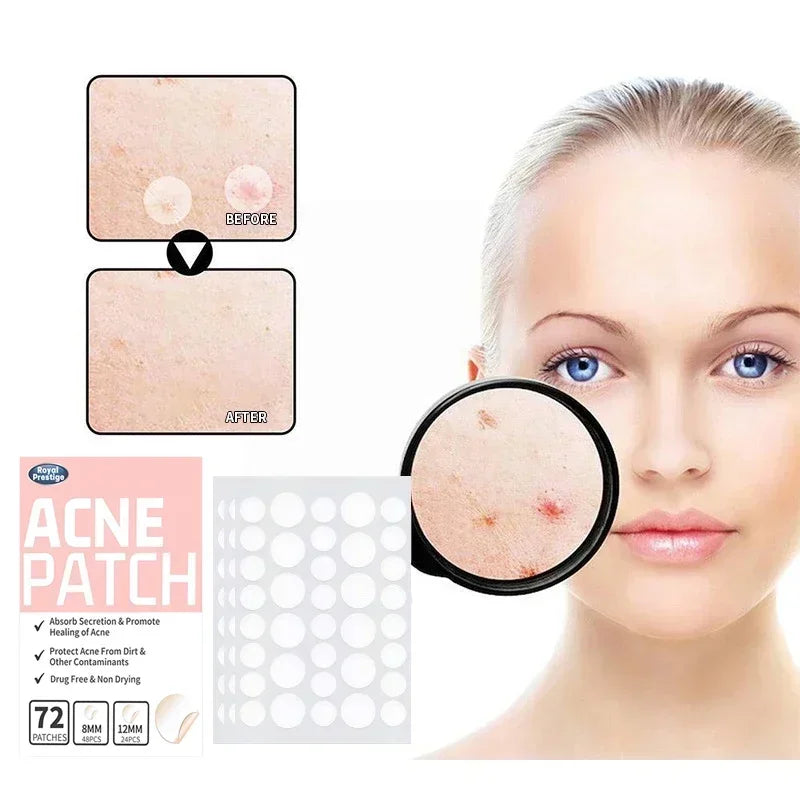 72/180Pcs Hydrocolloid Acne Patches